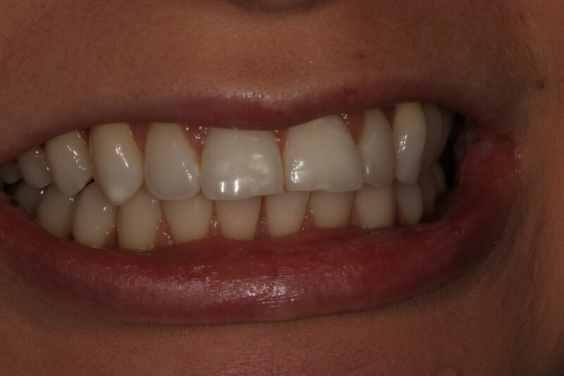 Before - Cheadle Hulme Dental