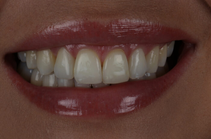 After - Cheadle Hulme Dental