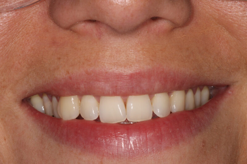 Before - Cheadle Hulme Dental