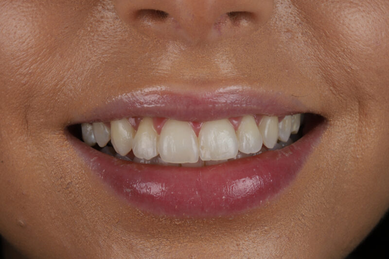 After - Cheadle Hulme Dental