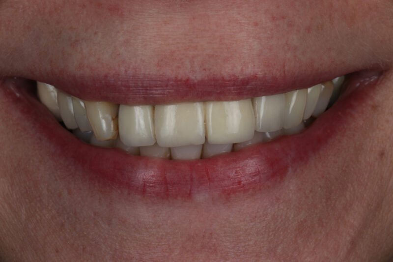 Before - Cheadle Hulme Dental