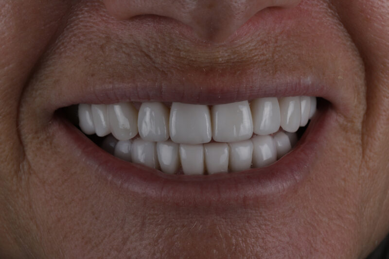 After - Cheadle Hulme Dental