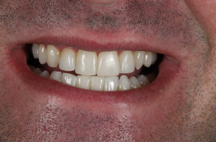 After - Cheadle Hulme Dental