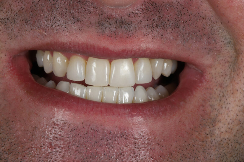 After - Cheadle Hulme Dental