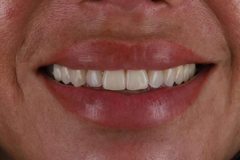 After - Cheadle Hulme Dental