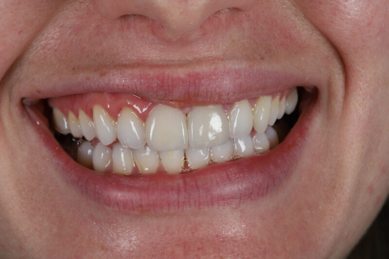 After - Cheadle Hulme Dental