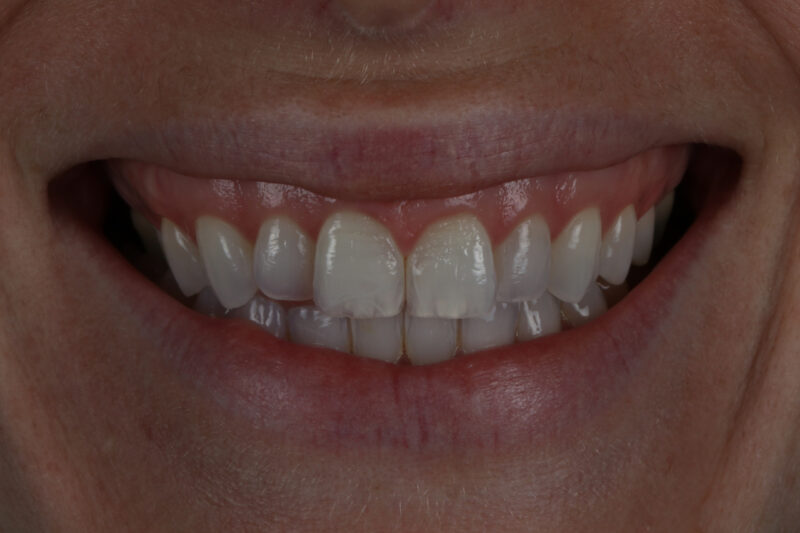 Before - Cheadle Hulme Dental