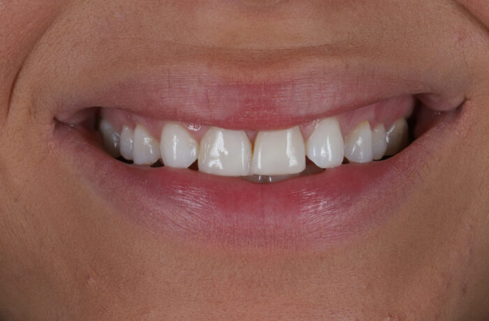 Before - Cheadle Hulme Dental