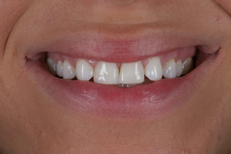 Before - Cheadle Hulme Dental