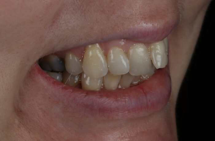 Before - Cheadle Hulme Dental