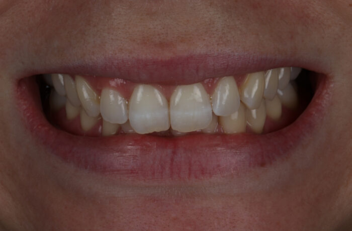 Before - Cheadle Hulme Dental