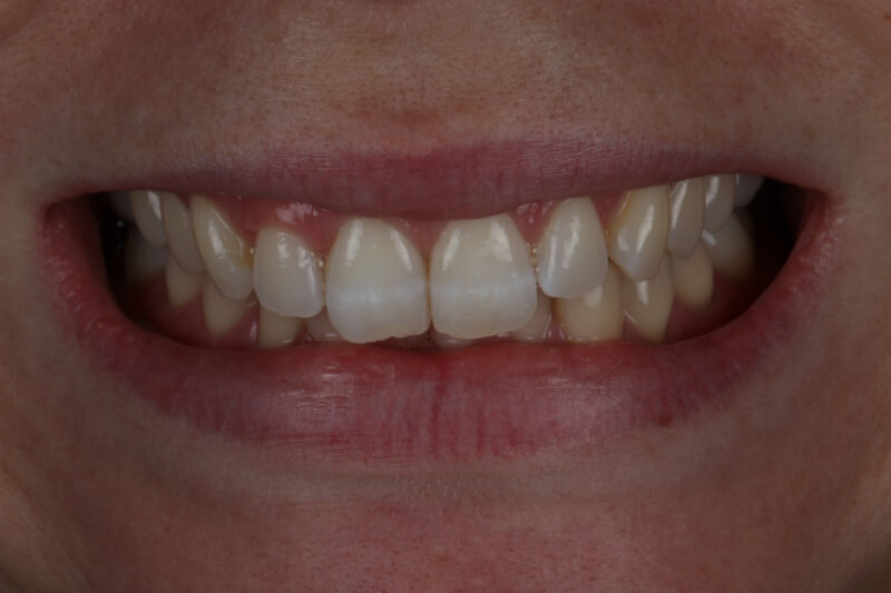 Before - Cheadle Hulme Dental