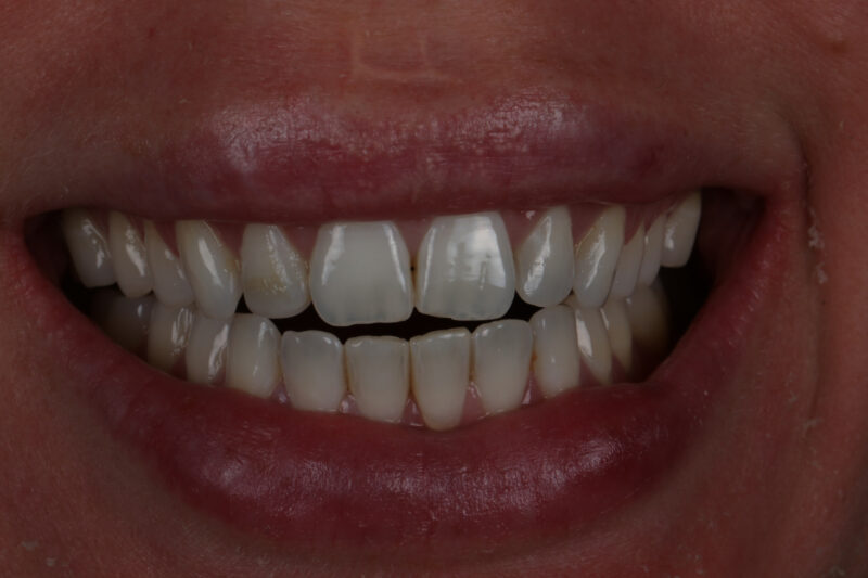 Before - Cheadle Hulme Dental