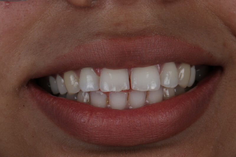 Before - Cheadle Hulme Dental