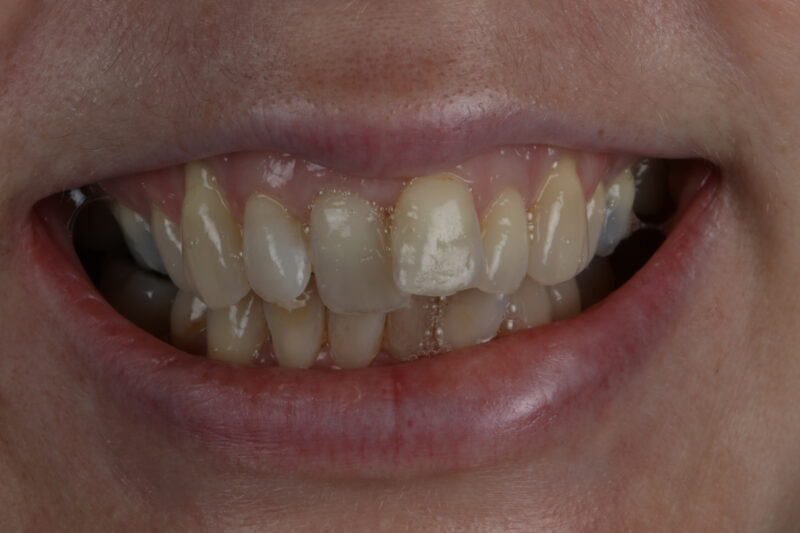 Before - Cheadle Hulme Dental