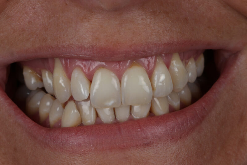 Before - Cheadle Hulme Dental