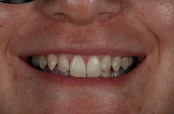 Before - Cheadle Hulme Dental