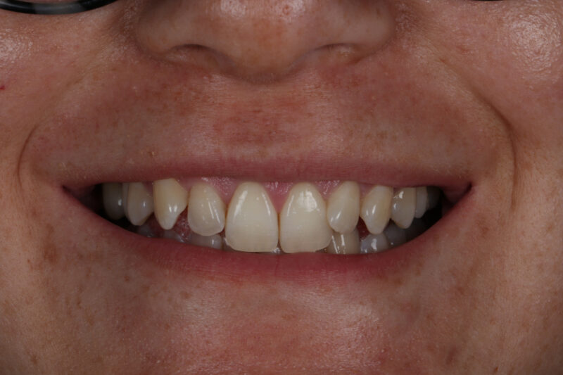 Before - Cheadle Hulme Dental