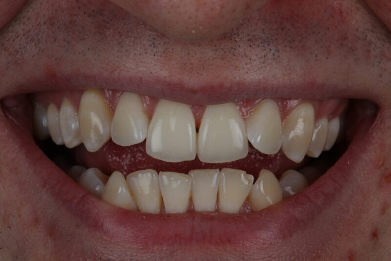 Before - Cheadle Hulme Dental