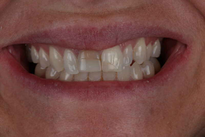 Before - Cheadle Hulme Dental