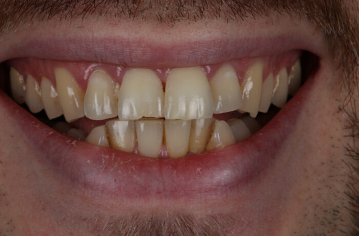 Before - Cheadle Hulme Dental