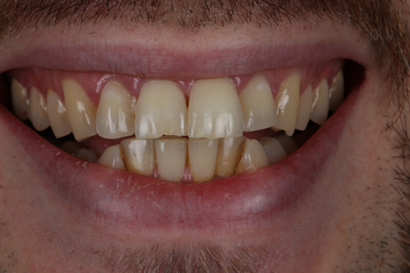 Before - Cheadle Hulme Dental