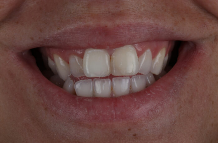 Before - Cheadle Hulme Dental