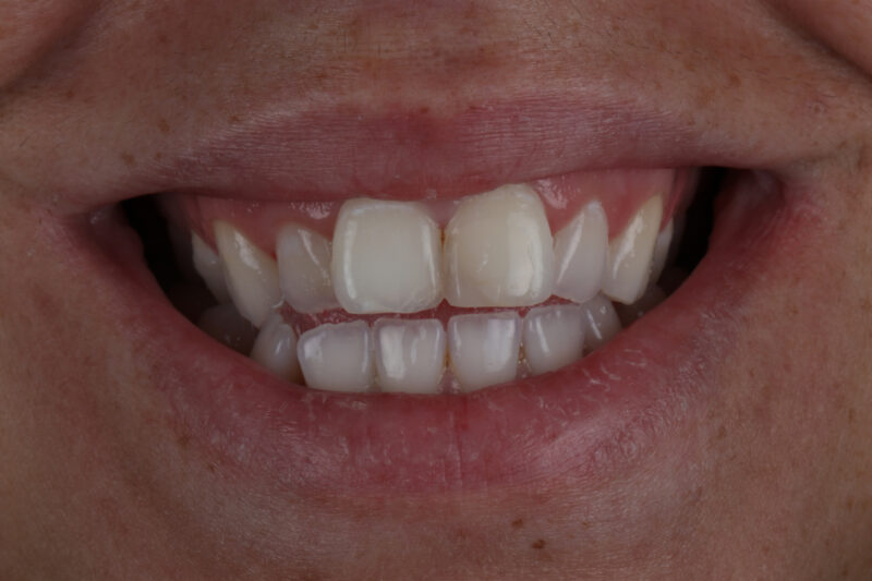 Before - Cheadle Hulme Dental