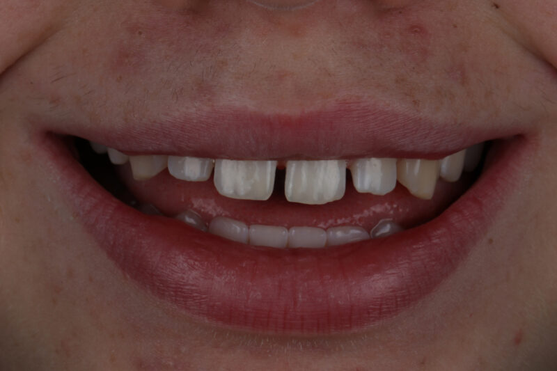 Before - Cheadle Hulme Dental