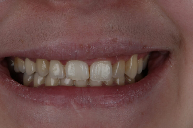 Before - Cheadle Hulme Dental