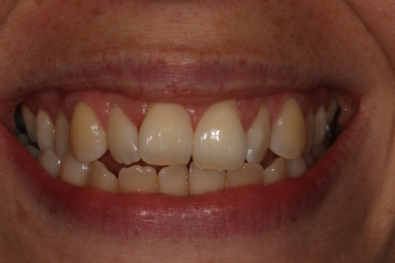 Before - Cheadle Hulme Dental