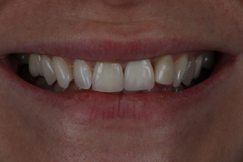 Before - Cheadle Hulme Dental