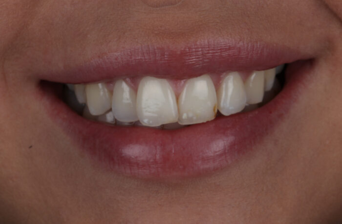 Before - Cheadle Hulme Dental