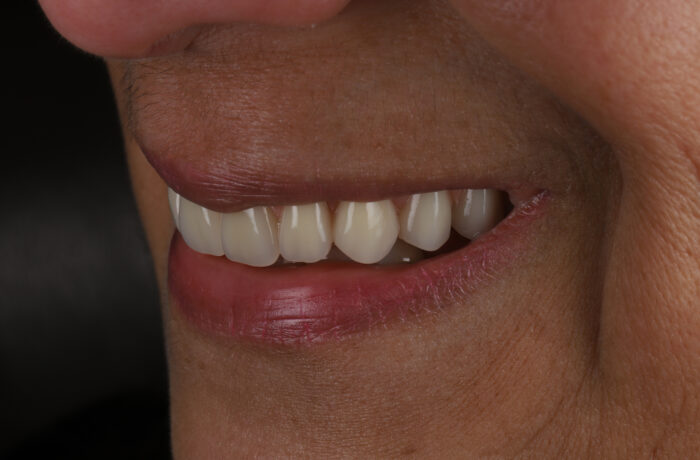 After - Cheadle Hulme Dental