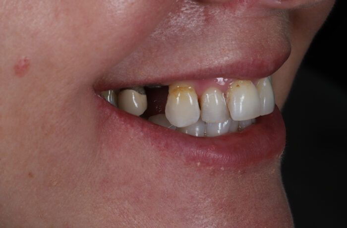 Before - Cheadle Hulme Dental