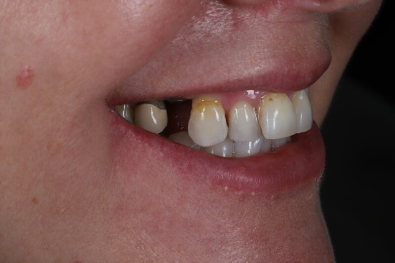 Before - Cheadle Hulme Dental