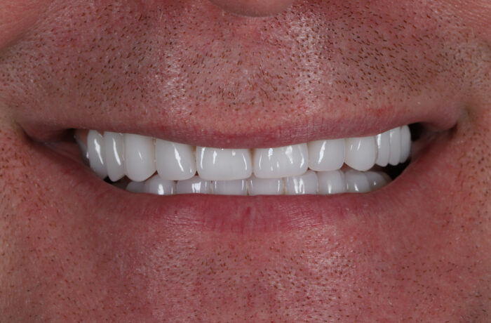 After - Cheadle Hulme Dental