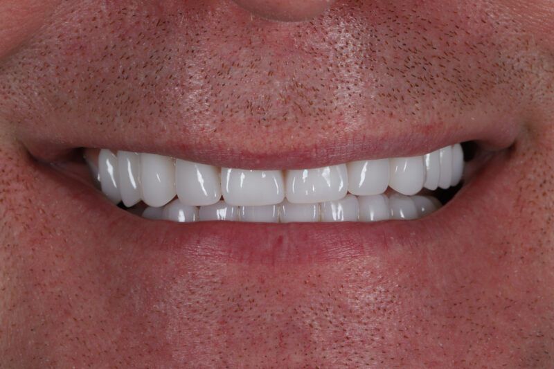 After - Cheadle Hulme Dental