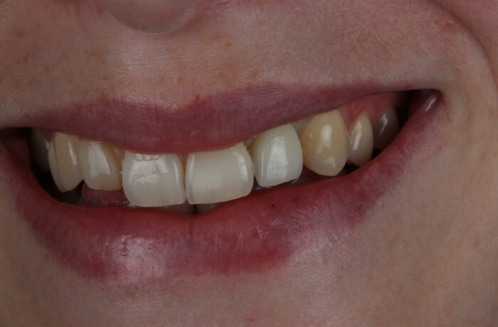 After - Cheadle Hulme Dental