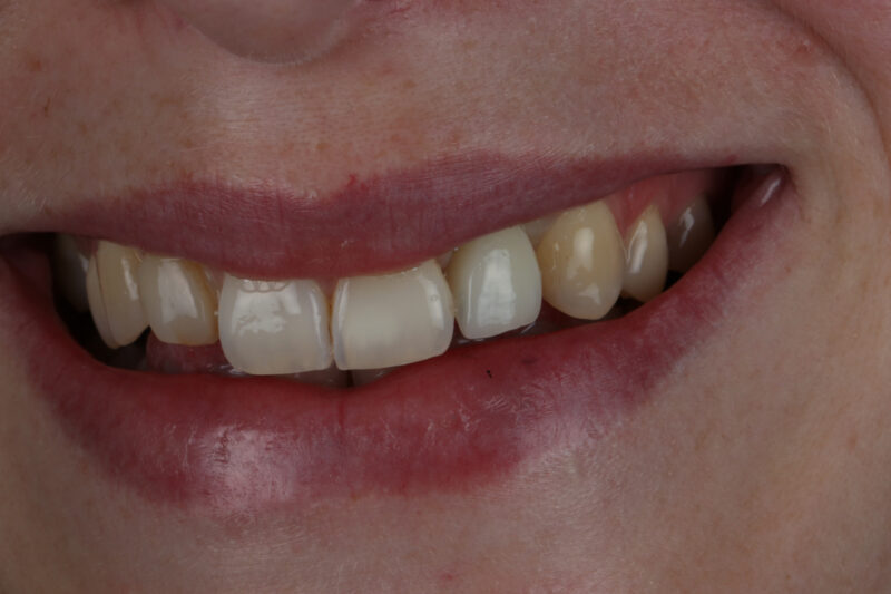 After - Cheadle Hulme Dental