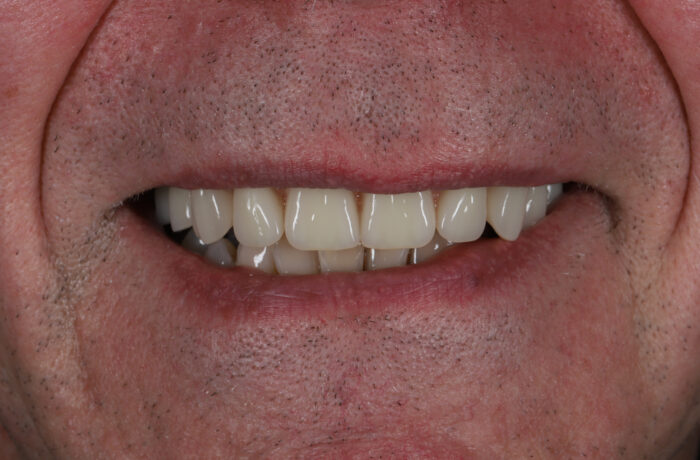 After - Cheadle Hulme Dental