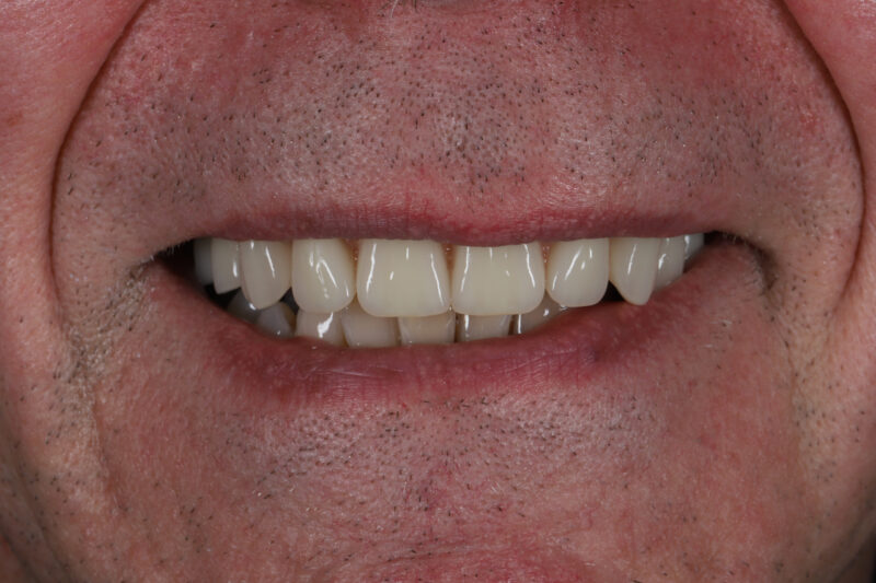 After - Cheadle Hulme Dental