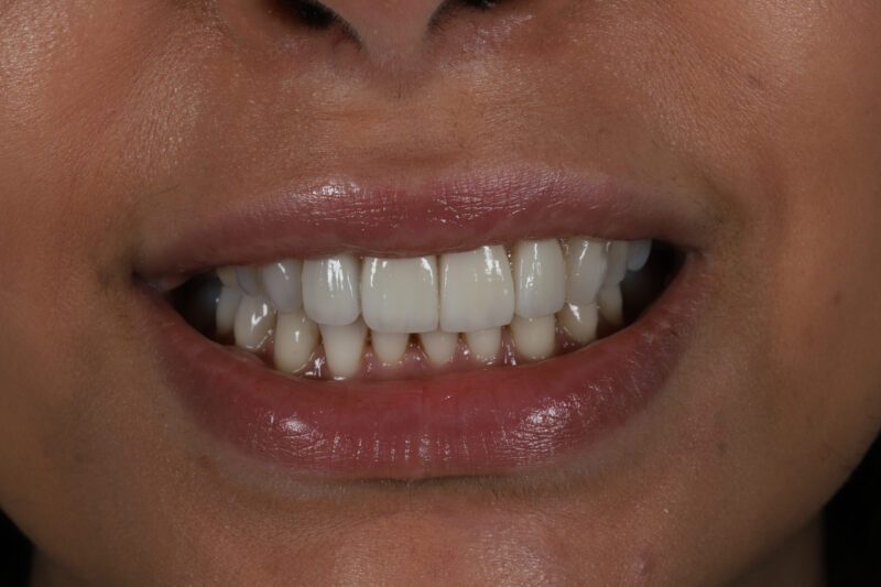 After - Cheadle Hulme Dental