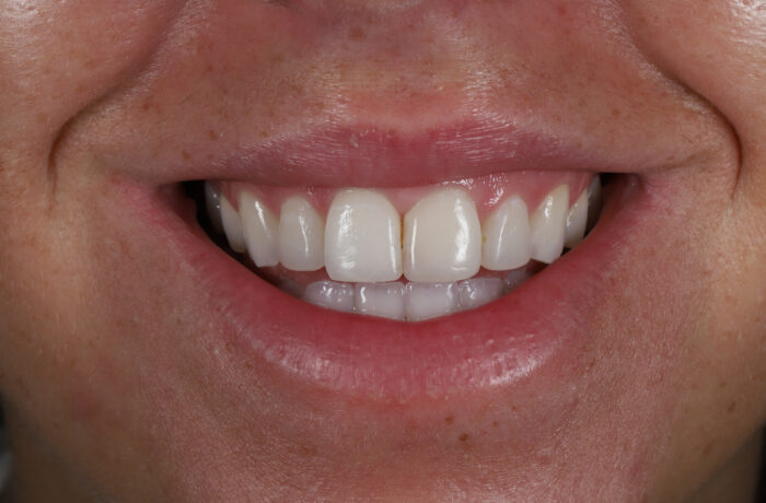 After - Cheadle Hulme Dental