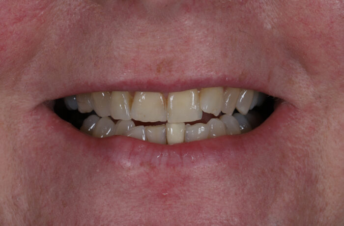 Before - Cheadle Hulme Dental