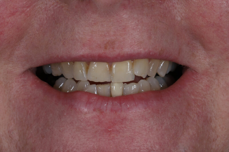 Before - Cheadle Hulme Dental