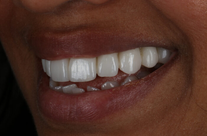 After - Cheadle Hulme Dental