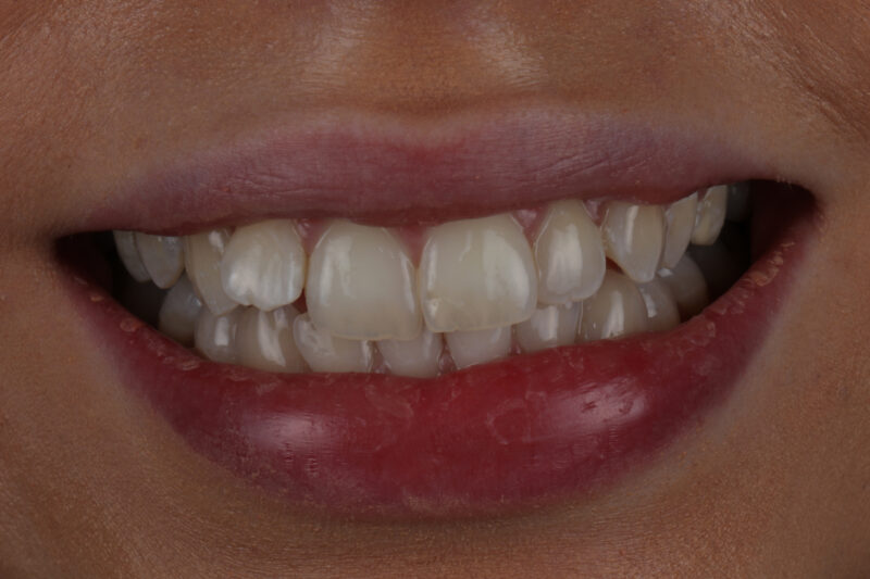 Before - Cheadle Hulme Dental