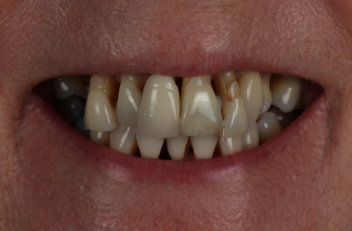 Before - Cheadle Hulme Dental