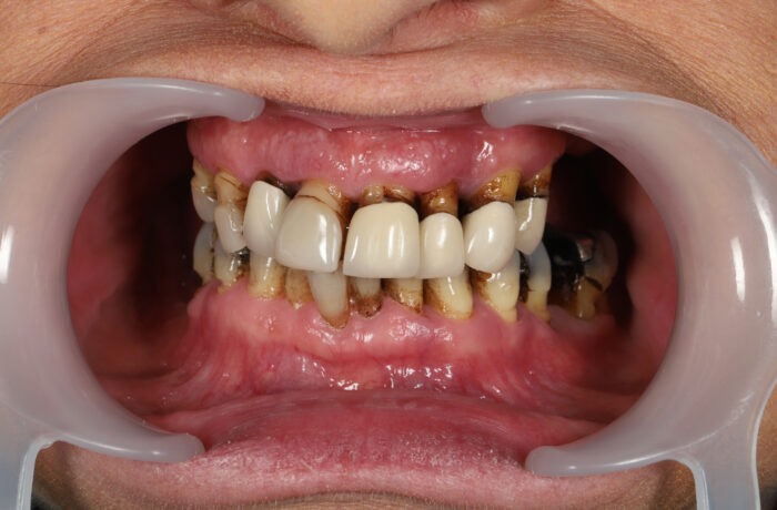 Before - Cheadle Hulme Dental